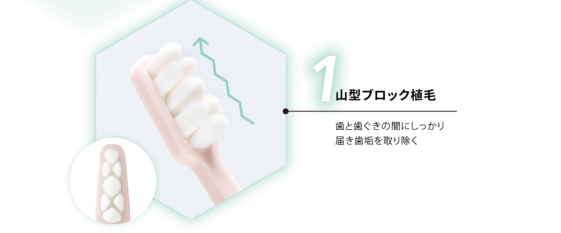 山型ブロック植毛 歯と歯ぐきの間にしっかり<br>届き歯垢を取り除く